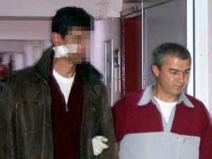 Kavgada yüzüne çatal saplandı