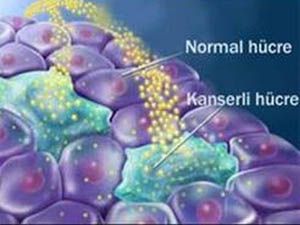 Kanser riskini nasıl azaltabilirsiniz?