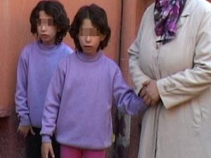 İkiz kardeşlere devlet sahip çıktı