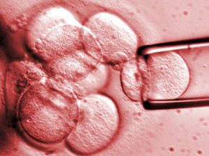 Konyaya kök hücre nakil merkezi