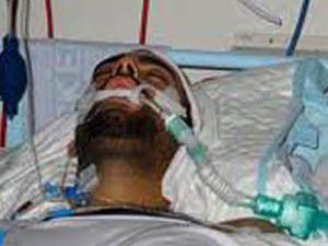 Sopalı saldırıya uğrayan Türk öldü