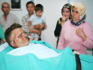 Baca temizleyim derken yüzünden oldu