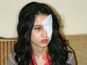 Akbabanın tedavisini Başkent Hastanesi üstlendi