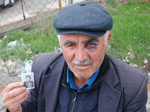 Kocasının gözünü morarttı!