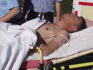 Çelik kapı takarken kafasına beton düştü!