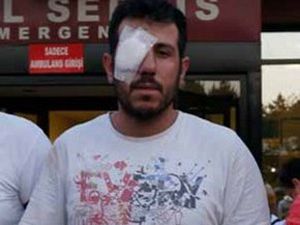 Gözünde çiviyle 7 saat hastane aradı