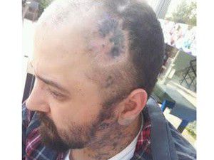 Her şey kanseri yenmek için!