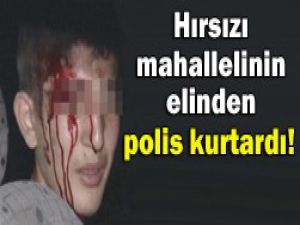 Linç edilmekten kurtuldu!