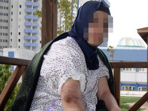 Arkadaşlık teklifini kabul etmediği için yaktı