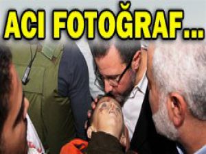 Günün acı fotoğrafı