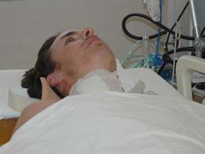 Ellerini kullanacak ama artık yürüyemeyecek