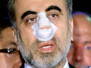 Yumruklar emniyette kafa koparttı