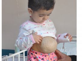 İç organları dışarıda olan Suriyeli çocuk sağlığına kavuştu