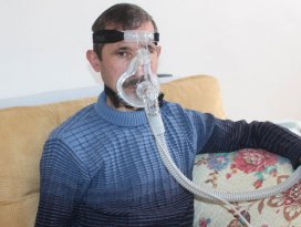 Hayatta kalması kalp ve akciğer nakline bağlı