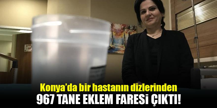 Dizlerinden 967 tane eklem faresi çıktı!