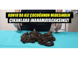 Konyada 12 yaşındaki kızın midesinden çıkanlar şaşırttı